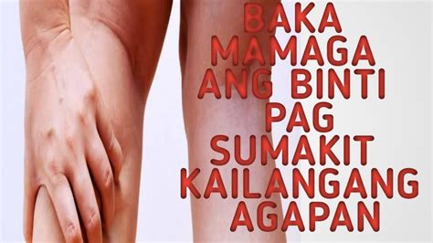 sugat sa tuhod|Tamang Alaga para sa Pananakit ng Tuhod, Binti, at Paa.